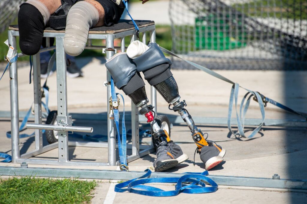 Two prosthetic leas leaning on a throwing chair.